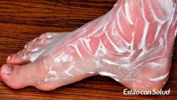 Crema Casera para Aliviar la Hinchazón y Dolores en las Piernas