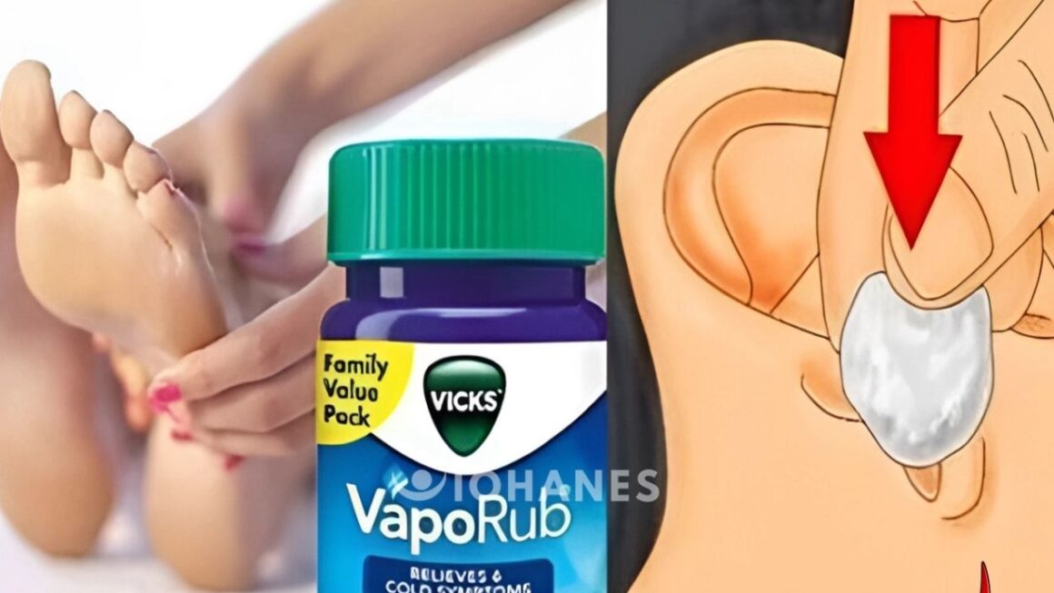 Vicks VapoRub
