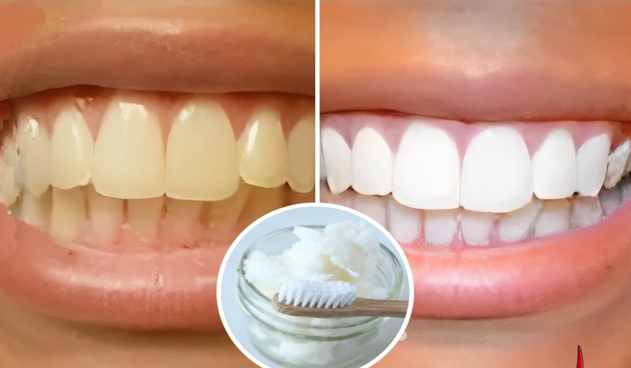 Pasta de Dientes Casera: Receta Detallada y Beneficios para Tratar Enfermedades de las Encías y Blanquear los Dientes
