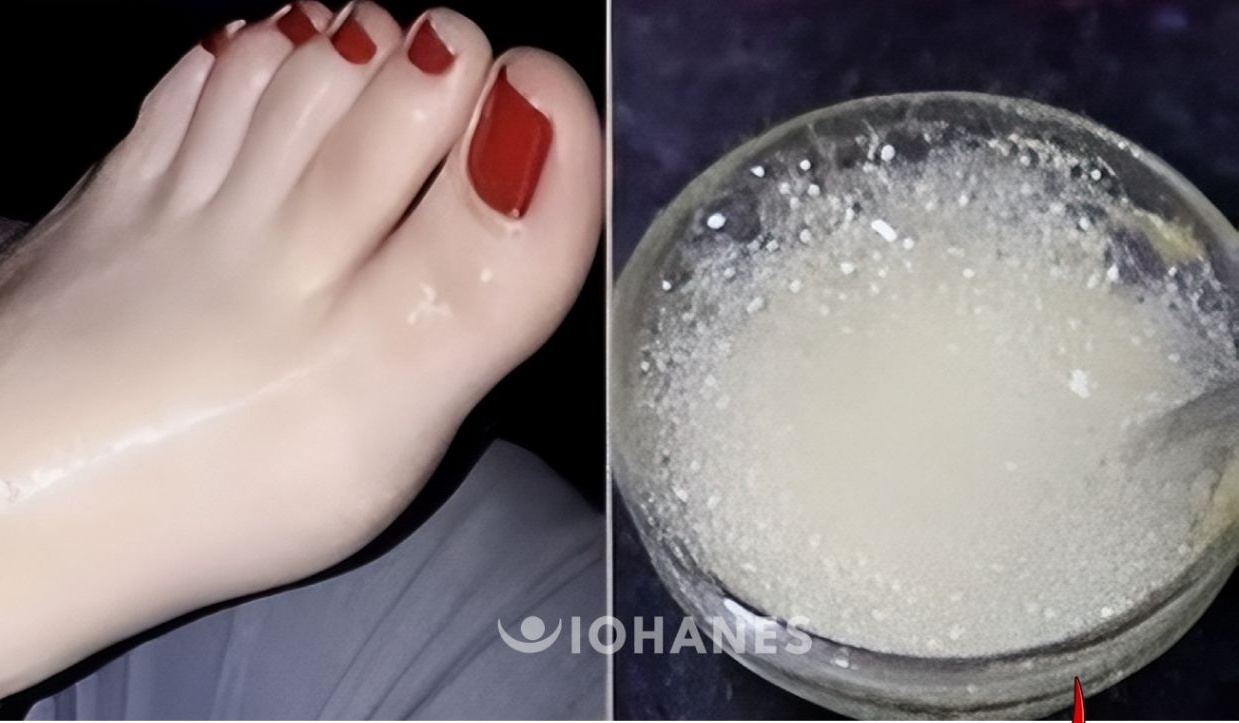 Remedios Caseros para Blanquear Pies, Manos, Rostro, Axilas y Cuello, Eliminando Años de Suciedad en Minutos