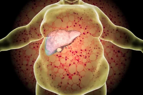 Señales Claras de un Hígado Sobrecargado de Grasa y Toxinas