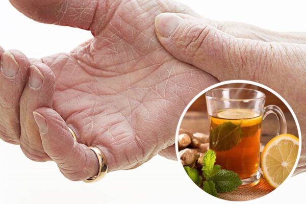 Remedios Naturales para el Dolor en Manos y Pies y la Artritis