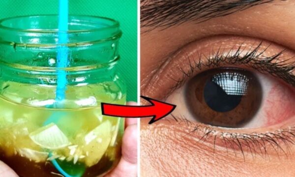 Botella Casera para la Visión: Limón, Ajo, Miel, Jengibre, Naranja y Manzanilla