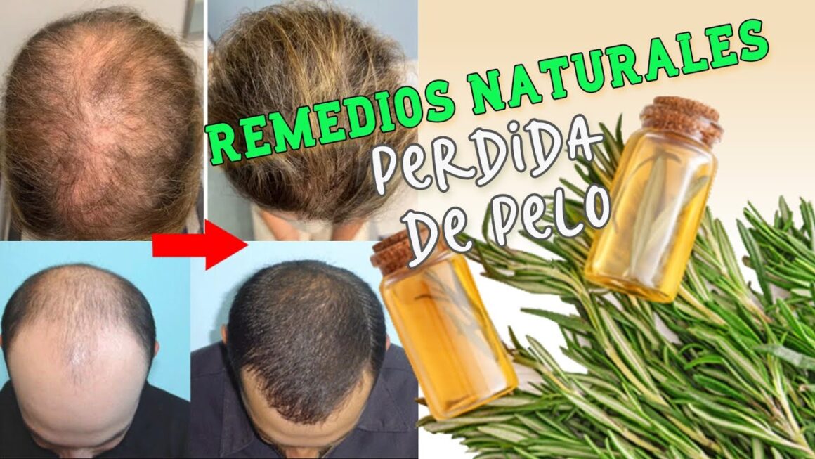Cabello
