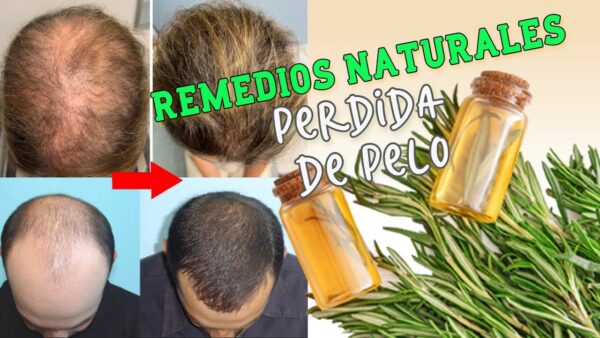 Remedios Caseros Efectivos para Combatir la Caída del Cabello y Fortalecer las Uñas