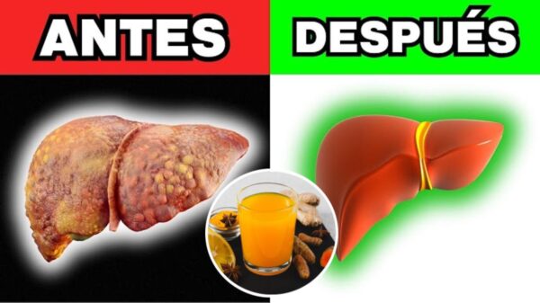 Con Solo Una Cucharada de Esta Bebida Antes de Dormir: Limpia tu Hígado de Forma Natural