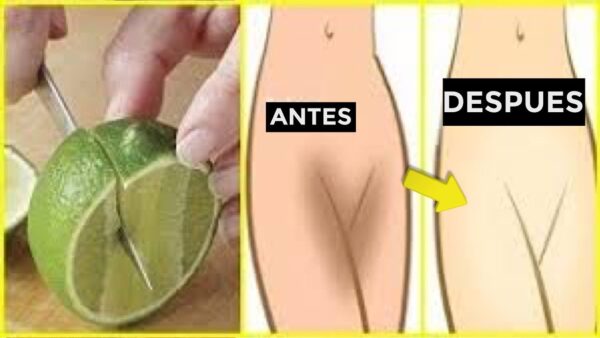 Blanquea la Piel Oscura de las Entrepiernas con Solo Dos Ingredientes