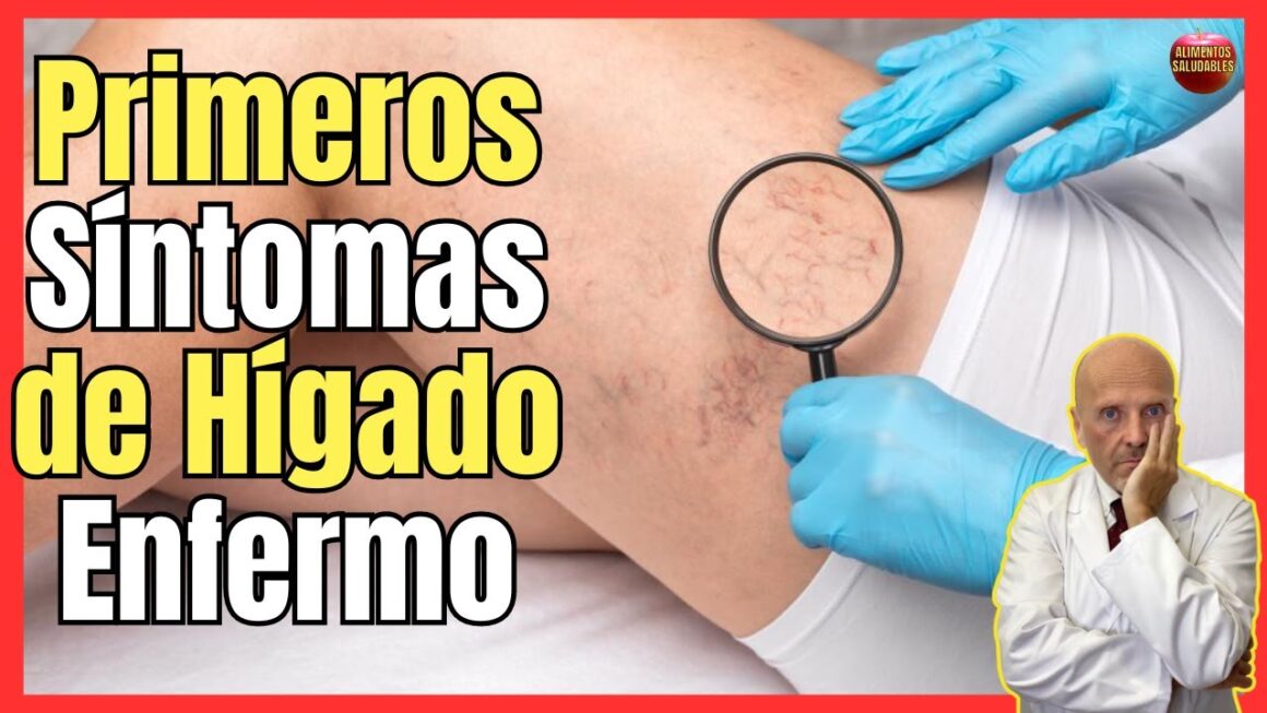 hígado