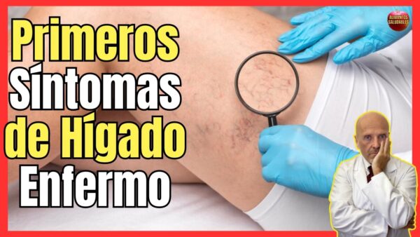 Señales de que tu hígado está fallando: Cómo detectarlas y qué hacer