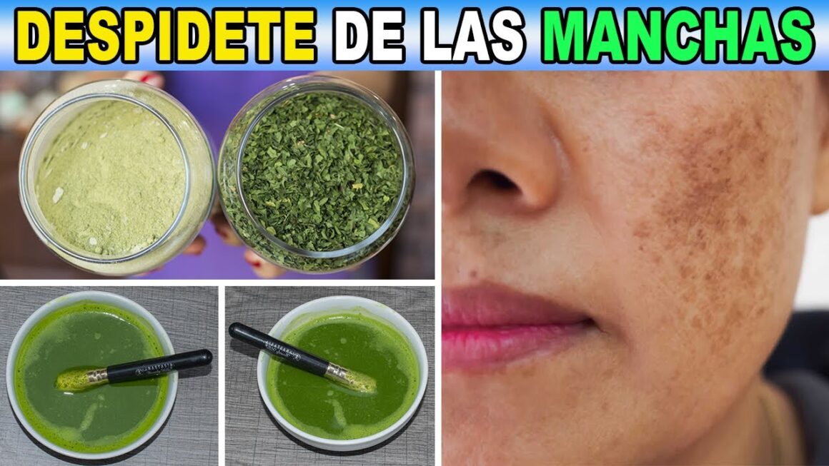 Manchas y Arrugas