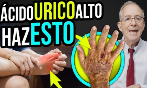 8 Maneras Fáciles de Eliminar el Exceso de Ácido Úrico: Recetas Naturales y Consejos Prácticos