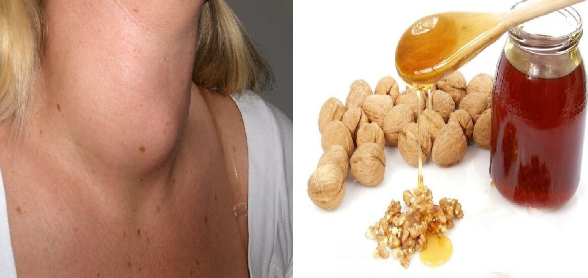 Miel y Nueces