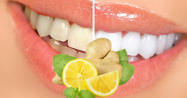 Blanquea tus dientes naturalmente con jengibre y limón: receta, beneficios y precauciones
