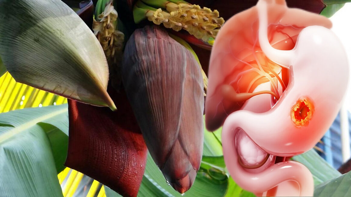 flor de plátano