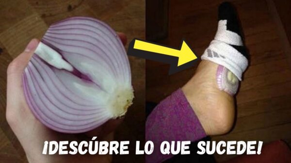 "Beneficios de aplicar cebolla con Vick en los pies"