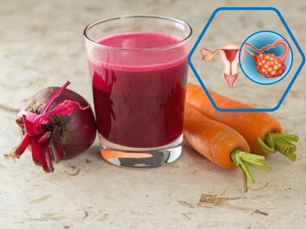 "Remolacha para la salud: Elimina anemia, quistes y miomas con este jugo"