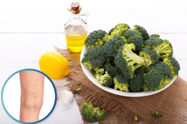 "Jugo para venas varicosas: brócoli, limón y miel"