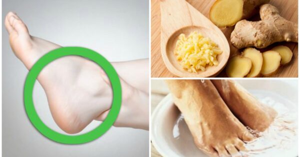 “20 beneficios de sumergir tus pies en agua de jengibre”
