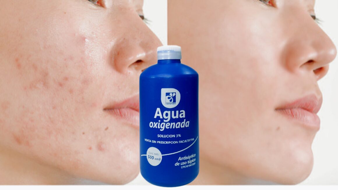 agua oxigenada