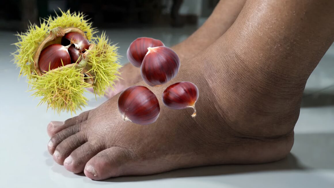 piernas