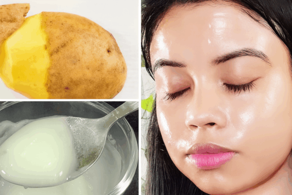 Gel de papa: aclara la piel y elimina manchas oscuras de forma natural